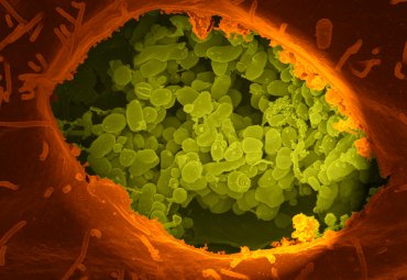 Desarrollo de sistema de detección rápida de Fiebre Q