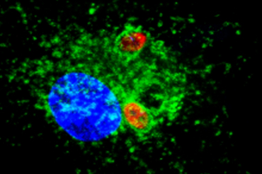 Leishmania: Conoce la investigación del nuevo profesor de TM